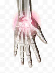 医疗科技创意合成手掌骨头