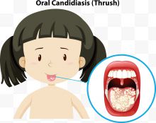女孩矢量口腔问题