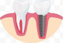 矢量白色假牙下载
