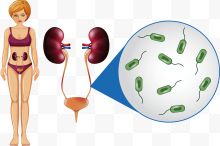 矢量人体输尿管细菌