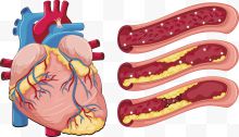 矢量心脏血管下载