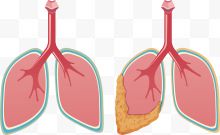 健康的肺与病变的肺...